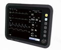Monitor funcții vitale EKG